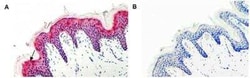 Serpin A12, Mouse anti-Human, Clone: VP63, Novus Biologicals:Antibodies:Primary