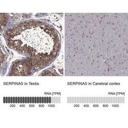 Serpin A5/Protein C Inhibitor Rabbit anti-Human, Polyclonal, Novus Biologicals:Antibodies:Primary