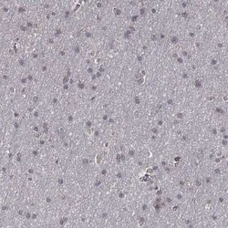 Serpin A5/Protein C Inhibitor Rabbit anti-Human, Polyclonal, Novus Biologicals:Antibodies:Primary
