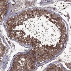Serpin A5/Protein C Inhibitor Rabbit anti-Human, Polyclonal, Novus Biologicals:Antibodies:Primary