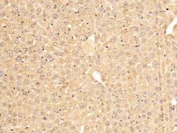 Serpin A7/TBG Antibody, Novus Biologicals 100 &mu;g, Unconjugated:Antibodies,