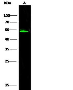 Serpin A8/Angiotensinogen Rabbit anti-Human, Clone: 1, Novus Biologicals