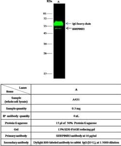 Serpin B3/SCCA1 Rabbit anti-Human, Clone: 18, Novus Biologicals 50 &mu;g;