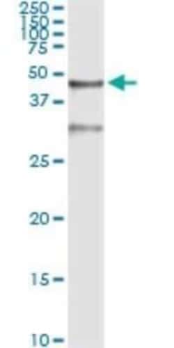 Serpin B3/SCCA1 Antibody (2F5), Novus Biologicals 0.1 mg | Buy Online | Novus Biologicals | Fisher Scientific