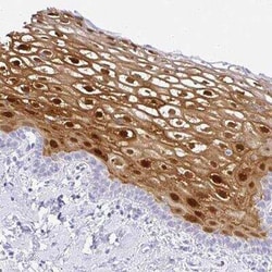 Serpin B3/SCCA1 Antibody, Novus Biologicals 25 &mu;L, Unconjugated:Antibodies,