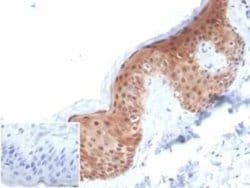Serpin B5/Maspin Mouse anti-Human, Clone: SERPINB5/4972, Novus Biologicals:Antibodies:Primary