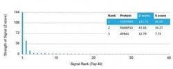 Serpin B5/Maspin Mouse anti-Human, Clone: SERPINB5/4972, Novus Biologicals:Antibodies:Primary