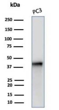 Serpin B5/Maspin Mouse anti-Human, Clone: SERPINB5/4972, Novus Biologicals:Antibodies:Primary