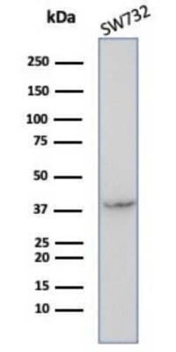 Serpin B5/Maspin Mouse anti-Human, Clone: SERPINB5/4972, Novus Biologicals:Antibodies:Primary