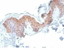 Serpin B5/Maspin Mouse anti-Human, Clone: SERPINB5/4977, Novus Biologicals