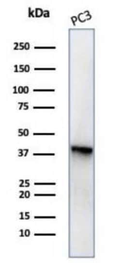 Serpin B5/Maspin Mouse anti-Human, Clone: SERPINB5/4977, Novus Biologicals