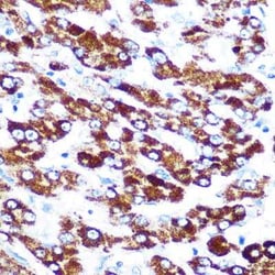 Serpin C1/Antithrombin-III Rabbit anti-Human, Mouse, Rat, Clone: 2X2V4,