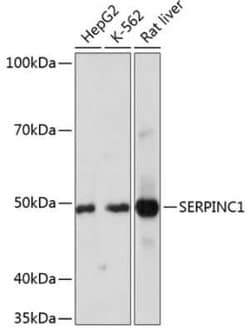 Serpin C1/Antithrombin-III Rabbit anti-Human, Mouse, Rat, Clone: 2X2V4,