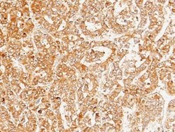 Serpin D1/Heparin Cofactor II Rabbit anti-Human, Clone: 8, Novus Biologicals