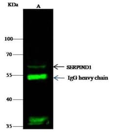 Serpin D1/Heparin Cofactor II Rabbit anti-Mouse, Clone: 25, Novus Biologicals:Antibodies:Primary