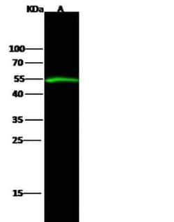 Serpin D1/Heparin Cofactor II Rabbit anti-Mouse, Clone: 25, Novus Biologicals:Antibodies:Primary