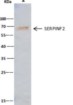 Serpin F2/alpha 2-Antiplasmin Rabbit anti-Human, Clone: 1, Novus Biologicals