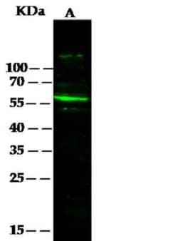 Serpin F2/alpha 2-Antiplasmin Rabbit anti-Human, Clone: 1, Novus Biologicals