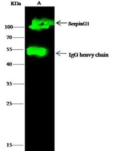 Serpin G1/C1 Inhibitor Rabbit anti-Human, Clone: 18, Novus Biologicals