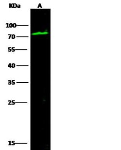 Serpin G1/C1 Inhibitor Rabbit anti-Human, Clone: 18, Novus Biologicals
