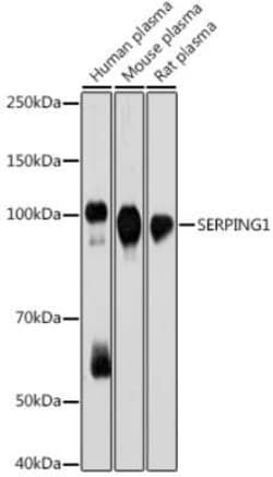 Serpin G1/C1 Inhibitor Rabbit anti-Human, Mouse, Rat, Clone: 0D3W8, Novus Biologicals 100 &mu;g | Buy Online | Novus Biologicals | Fisher Scientific