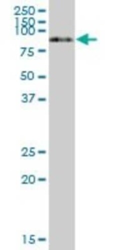Serpin G1/C1 Inhibitor Antibody, Novus Biologicals 0.05 mg | Buy Online | Novus Biologicals | Fisher Scientific