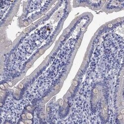 SerpinB2 Rabbit anti-Human, Polyclonal, Novus Biologicals:Antibodies:Primary