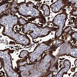 SerpinB2 Rabbit anti-Human, Polyclonal, Novus Biologicals:Antibodies:Primary