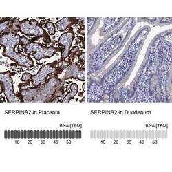 SerpinB2 Rabbit anti-Human, Polyclonal, Novus Biologicals:Antibodies:Primary