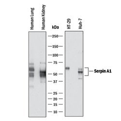 Human Serpin A1/alpha 1-Antitrypsin Antibody, R D Systems:Antibodies:Primary