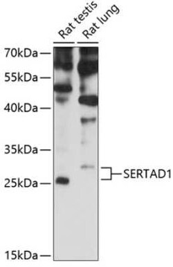 Sertad1 Antibody - Azide and BSA Free, Novus Biologicals 0.1 mL; Unconjugated:Antibodies,