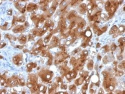 Serum Amyloid A1/A2 Mouse anti-Human, Clone: SAA/326, Novus Biologicals