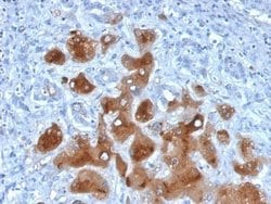 Serum Amyloid A1/A2 Mouse anti-Human, Clone: SAA/326, Novus Biologicals