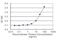 Serum Amyloid A1 Antibody (3C11-2C1), Novus Biologicals 0.1 mg | Buy Online | Novus Biologicals | Fisher Scientific