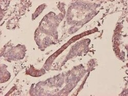 Serum Amyloid A1 Antibody (3C11-2C1), Novus Biologicals 0.1 mg | Buy Online | Novus Biologicals | Fisher Scientific