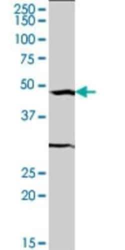 Serum Response Factor SRF Antibody (2C9), Novus Biologicals 0.1 mg | Buy Online | Novus Biologicals | Fisher Scientific