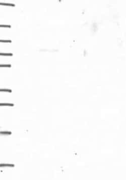 Shugoshin Rabbit anti-Human, Polyclonal, Novus Biologicals 100 &mu;g; Unconjugated:Antibodies,