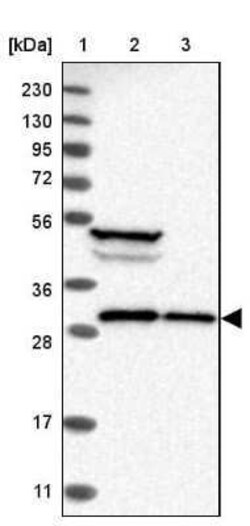 Ribosome maturation protein SBDS Antibody, Novus Biologicals 25 &mu;L;