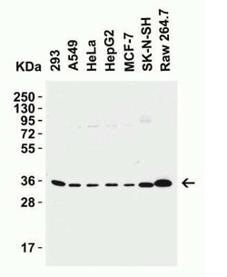 Siglec-15 Antibody - BSA Free, Novus Biologicals 0.1 mg; Unconjugated:Antibodies,