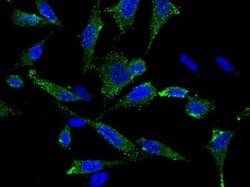 Siglec-2/CD22 Rabbit anti-Human, Clone: 340, Novus Biologicals:Antibodies:Primary