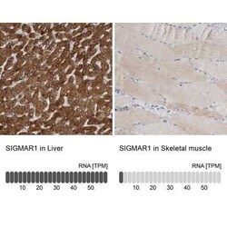 Sigma-1 R/OPRS1 Antibody, Novus Biologicals:Antibodies:Primary Antibodies