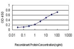 Signal sequence receptor delta Antibody (2D3), Novus Biologicals 0.1 mg | Buy Online | Novus Biologicals | Fisher Scientific