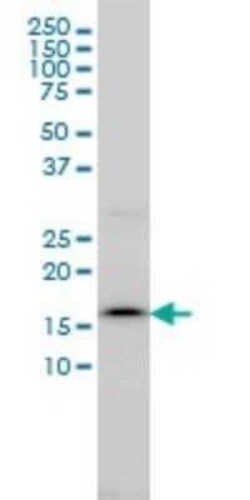 Signal sequence receptor delta Antibody (2D3), Novus Biologicals 0.1 mg | Buy Online | Novus Biologicals | Fisher Scientific