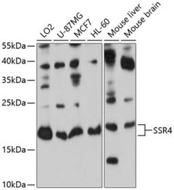 Signal sequence receptor delta Antibody - BSA Free, Novus Biologicals:Antibodies:Primary