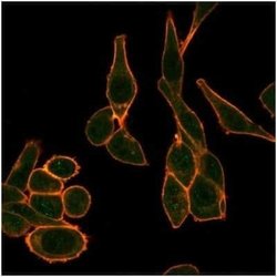 Sirtuin 1/SIRT1 Mouse anti-Human, Clone: PCRP-SIRT1-1E11, Novus Biologicals:Antibodies:Primary