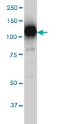 Sirtuin 1/SIRT1 Antibody (7B7), Novus Biologicals 0.1 mg | Buy Online | Novus Biologicals | Fisher Scientific
