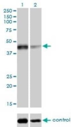 Sirtuin 2/SIRT2 Antibody (4B11), Novus Biologicals 0.1 mg | Buy Online | Novus Biologicals | Fisher Scientific
