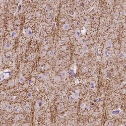 Sirtuin 2/SIRT2 Antibody, Novus Biologicals 25 &mu;L; Unconjugated:Antibodies,