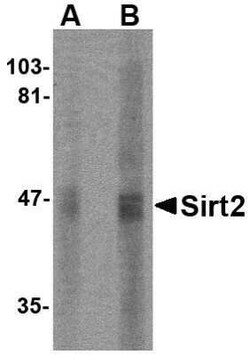 Sirtuin 2/SIRT2 Antibody - BSA Free, Novus Biologicals:Antibodies:Primary