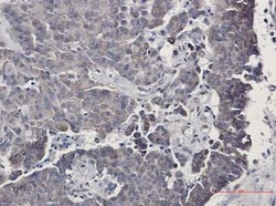 Sirtuin 3/SIRT3 Rabbit anti-Human, Clone: S03-1F5, Novus Biologicals:Antibodies:Primary